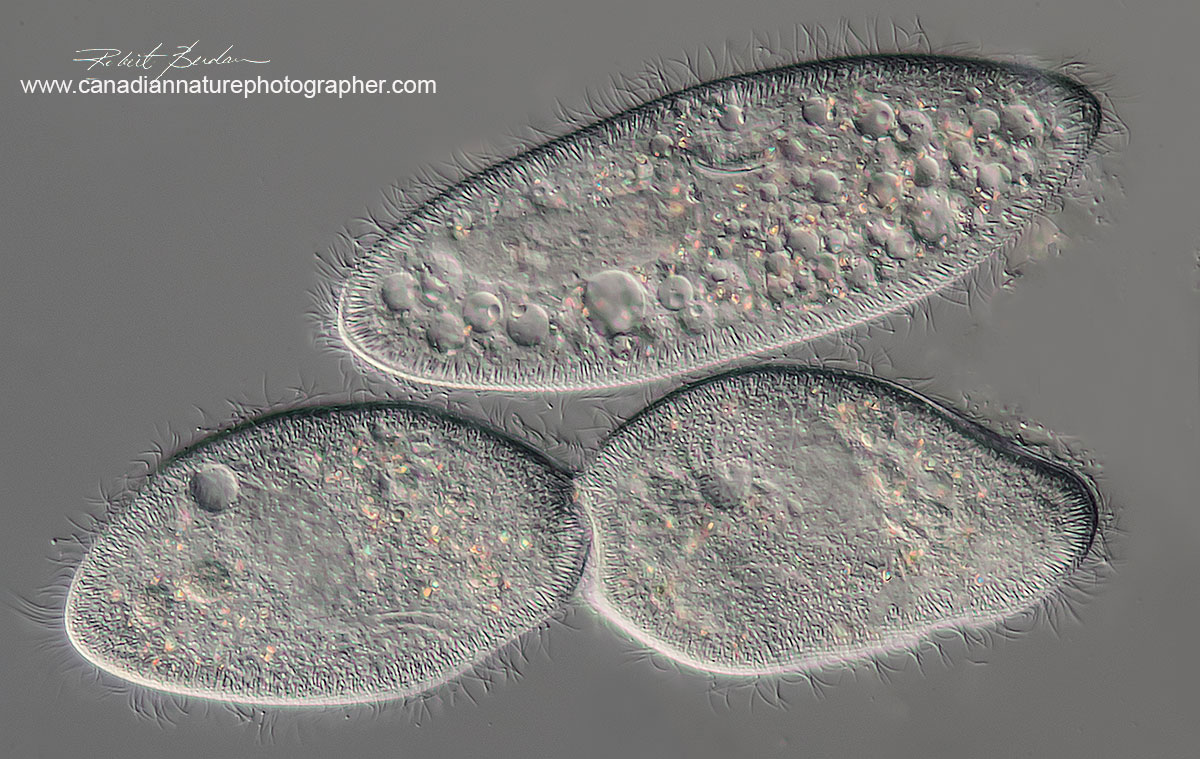 Paramecium dividing photographed by DIC microscopy by Robert Berdan ©