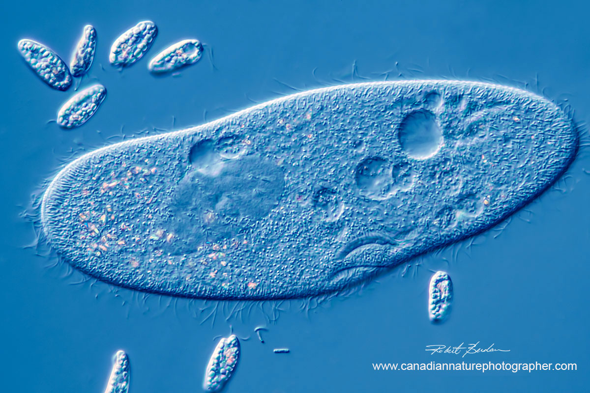 Paramecium caudatum surrounded by smaller euglenoids, 400X DIC microscopy by Robert Berdan ©