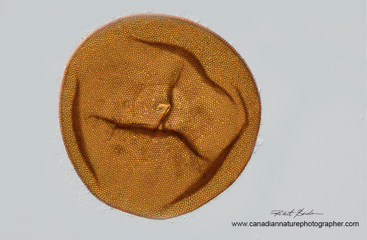 Amoeba Test or shell belonging to an Arcella sp. (Order Arcellinida) by Robert Berdan ©