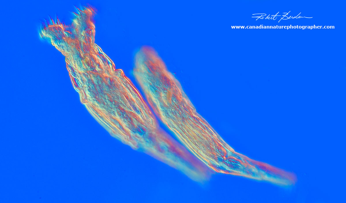 Female bdelloid rotifers DIC microscopy by Robert Berdan ©