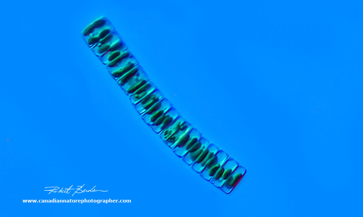 Fragaliaria sp of Daitom forming a long chain 400X DIC microscopy  by Robert Berdan ©