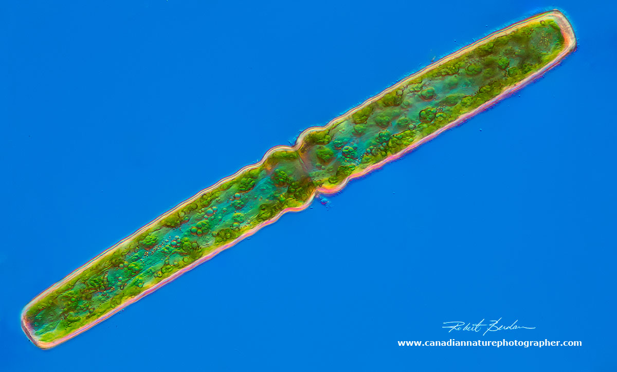 Desmid Pleurotanium sp. 200X DIC microscopy. by Robert Berdan ©