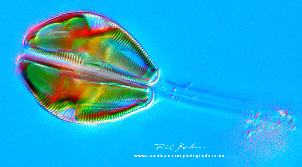 Cymbella sp of Diatom growing on a stalk 400X DIC microscopy by Robert Berdan ©