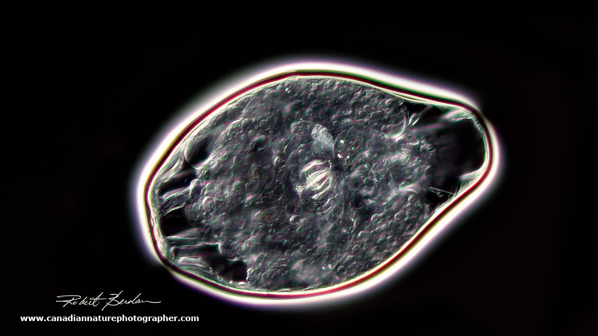 rotifer cyst by Darkfield microscopy by Robert Berdan ©