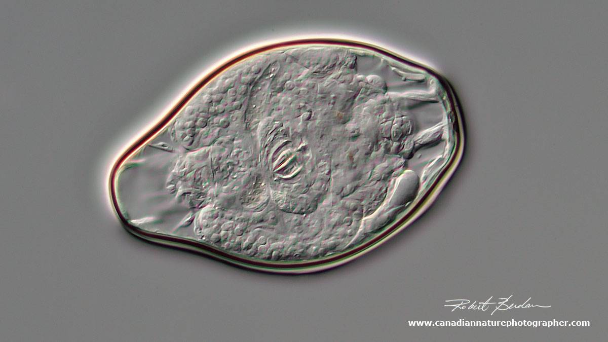 rotifer cyst DIC microscopy by Robert Berdan ©