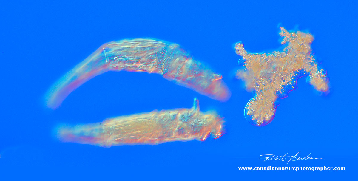 Bdelloid rotifers encountering an Amoeba 200X DIC microscopy by Robert Berdan ©