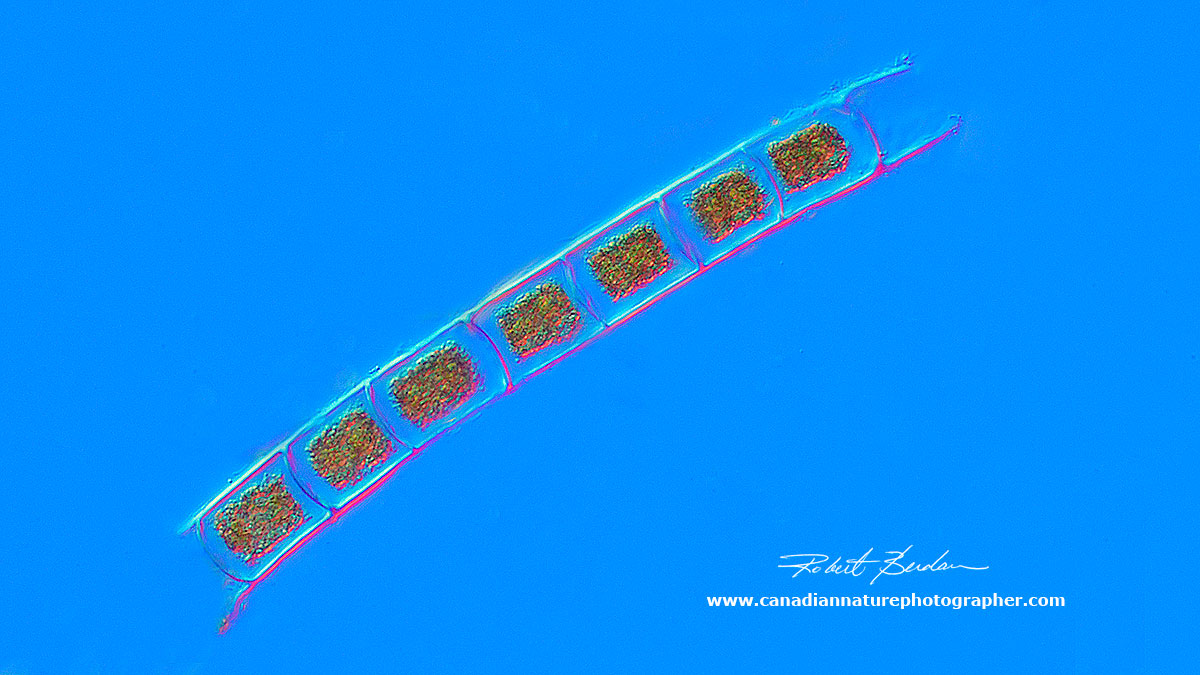 Tribonema - unbranched filamentous algae by DIC microscopy by Robert Berdan ©
