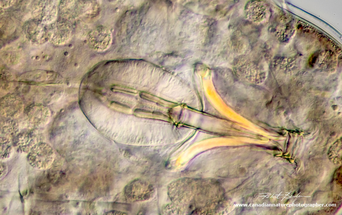 Pharyngeal apparatus near the head of the Tardigrade. DIC microscopy by Robert Berdan ©
