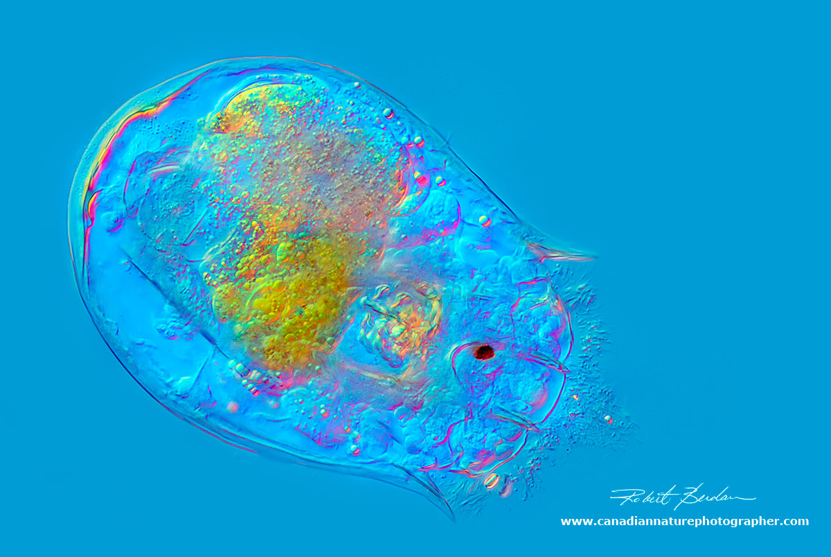 Rotifer - Notholca sp DIC microscopy by Robert Berdan ©