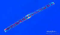 Bdelloid rotifer DIC microscopy 200X by Robert Berdan 