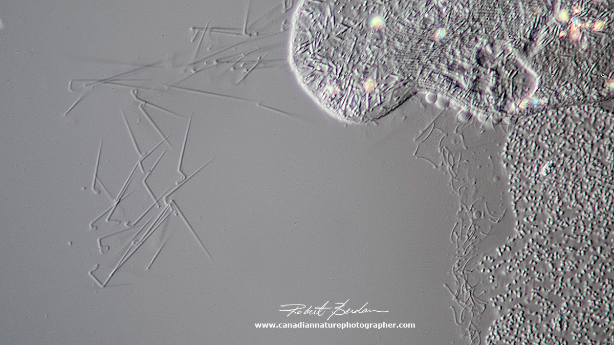 Paramecium trichocysts by DIC microscopy Robert Berdan ©