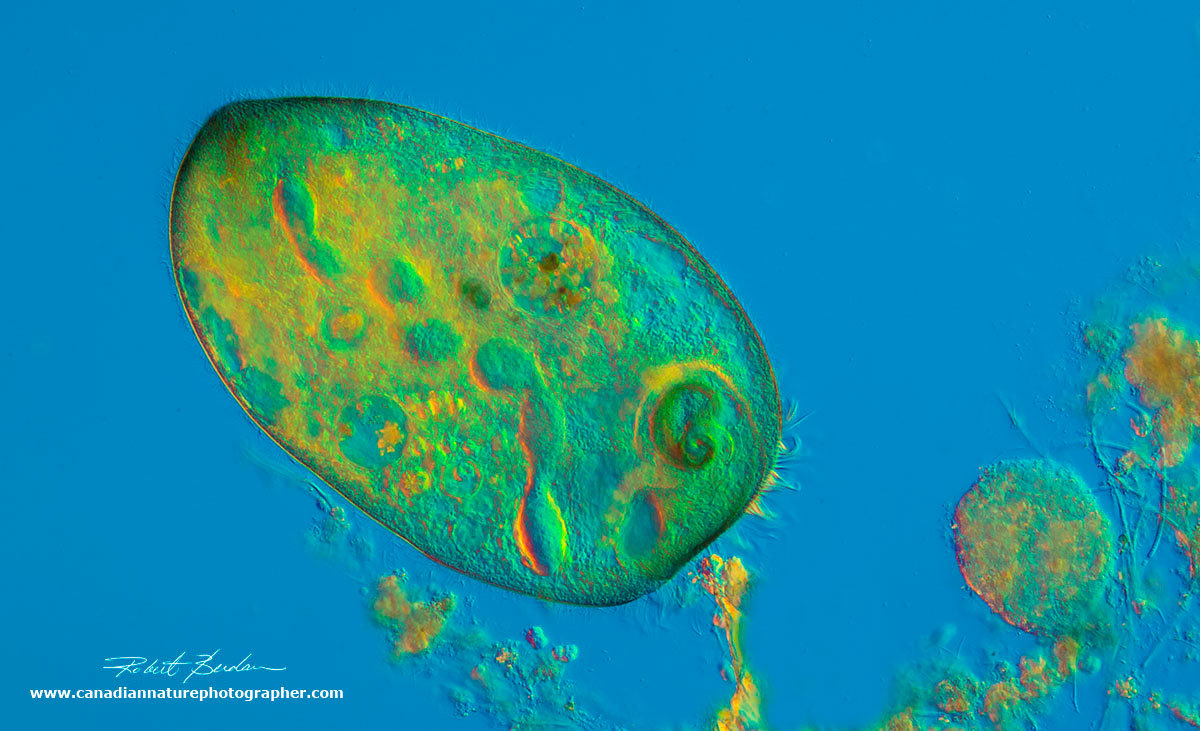 Stentor coeruleus seaching for food DIC microscopy by Robert Berdan ©