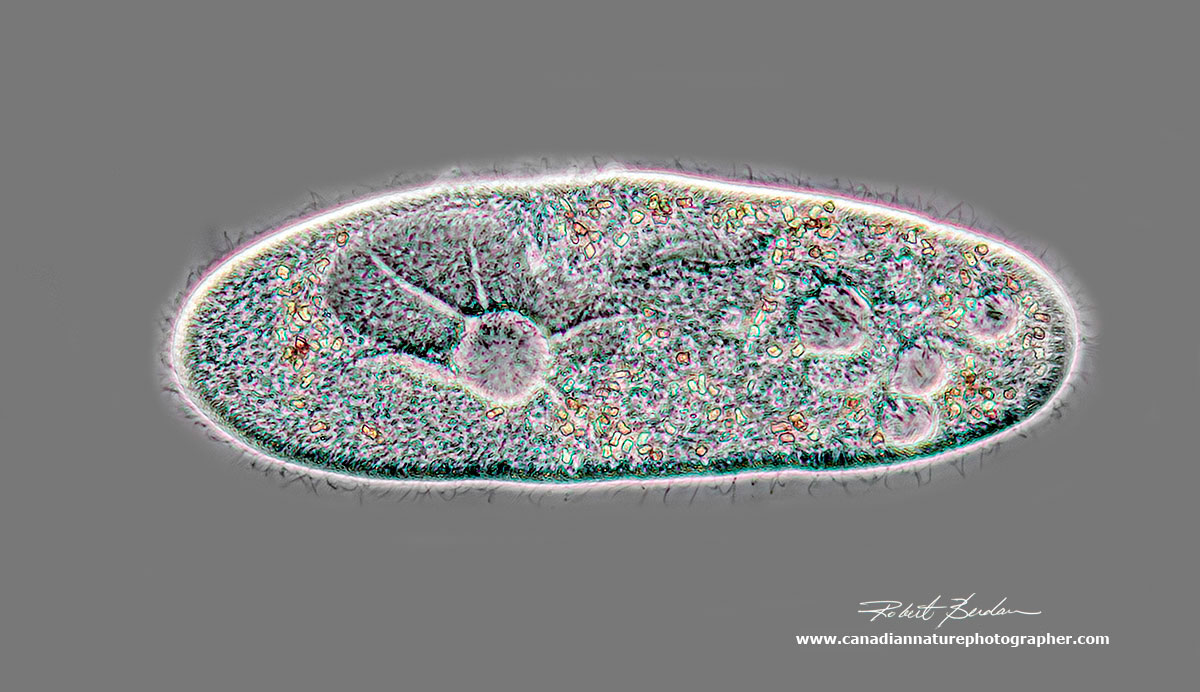 Paramecium caudatum viewed by Phase contrast microscopy - about 400X by Robert Berdan ©