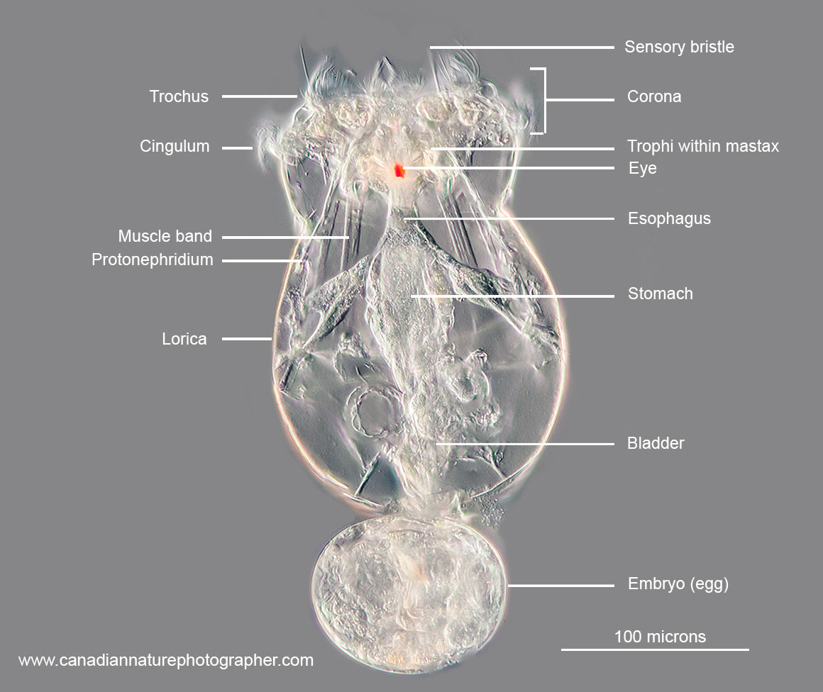 Female Brachionus manjavacas by DIC microscopy Robert Berdan ©