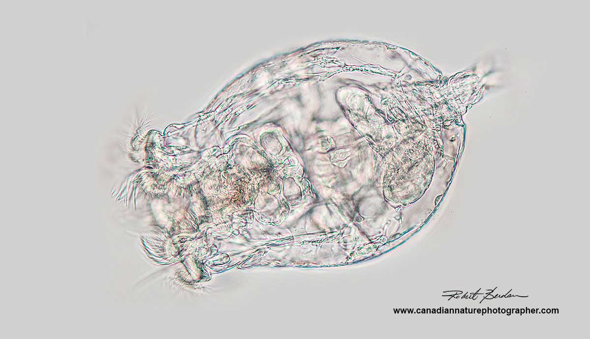 Brachionus manjavacas viewed by brightfield microscopy 400X Dr. Robert Berdan ©