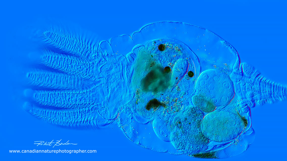 Stephanocereos fimbriatus 200X DIC microscopy Robert Berdan ©