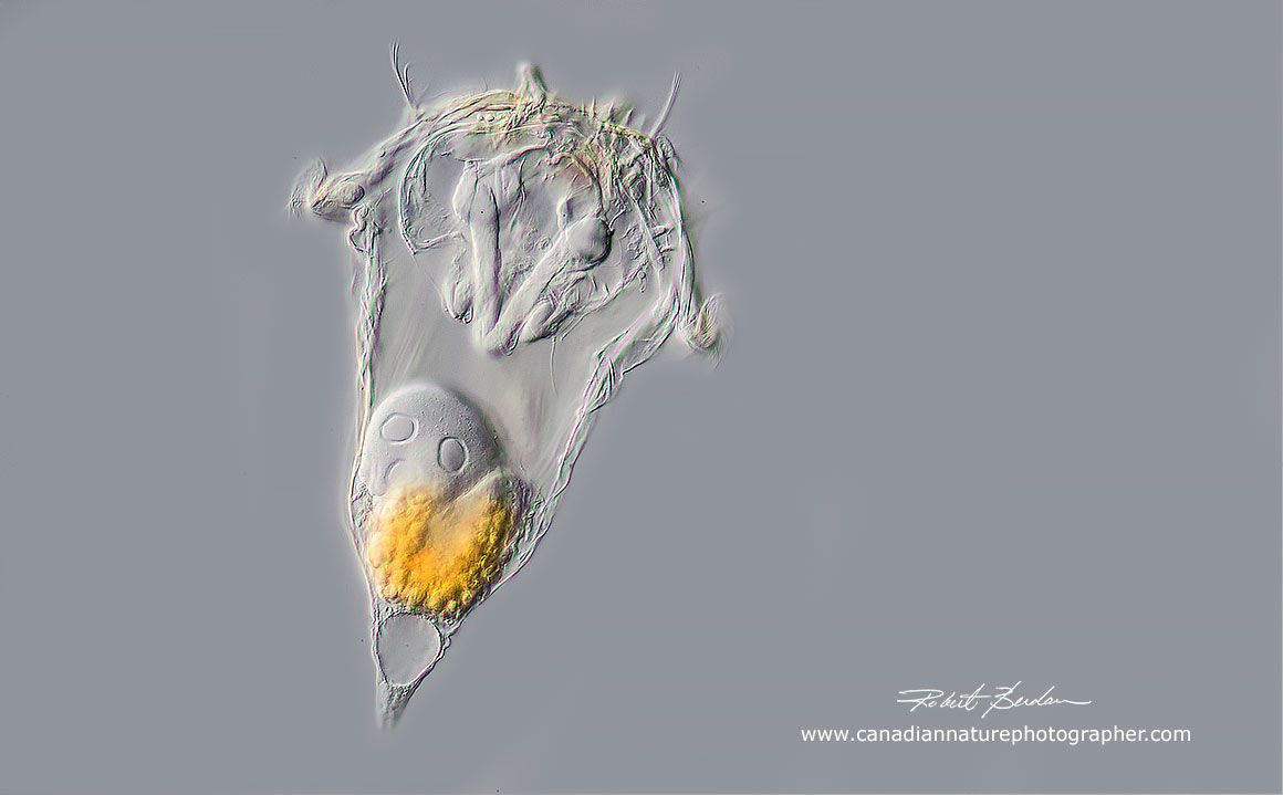 Synchaeta sp 200X DIC microscopy by Robert Berdan ©