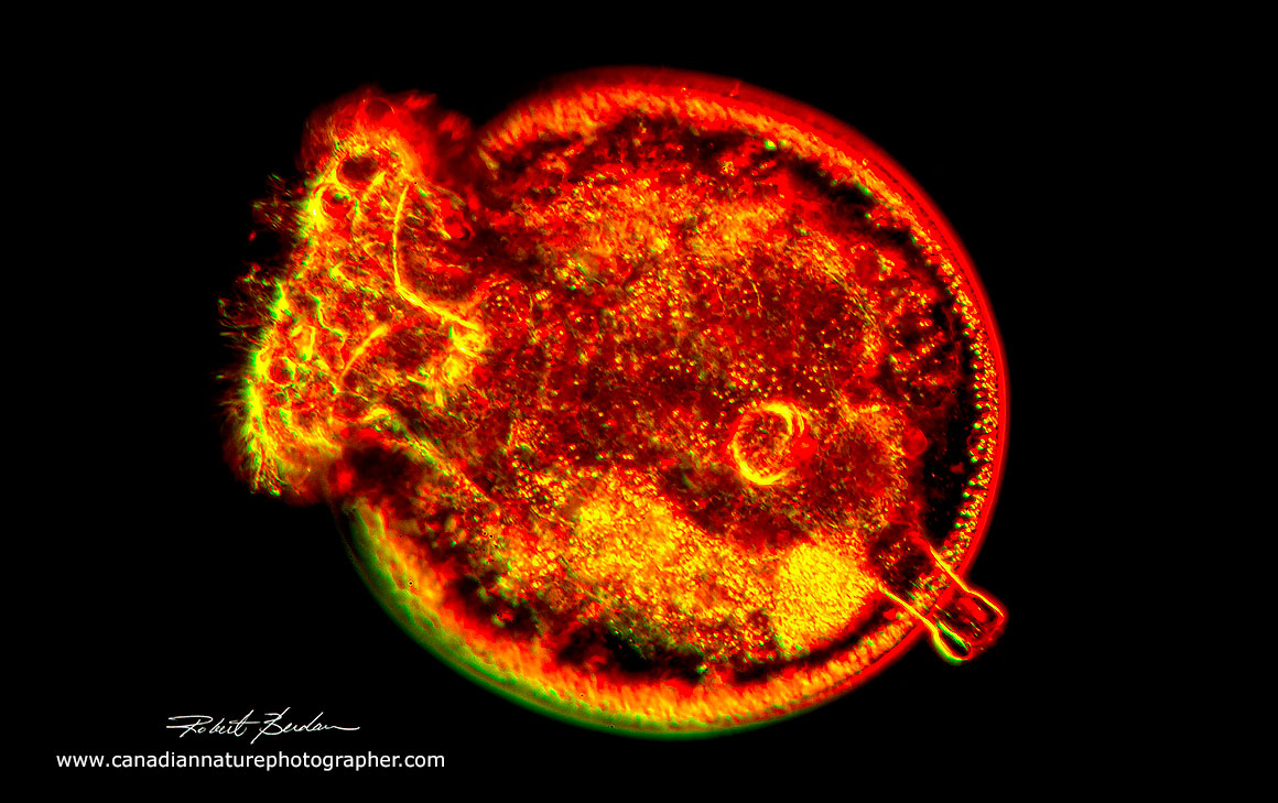 The Turtle rotifer Testudinella patina Rheinberg lighting 200X Robert Berdan ©