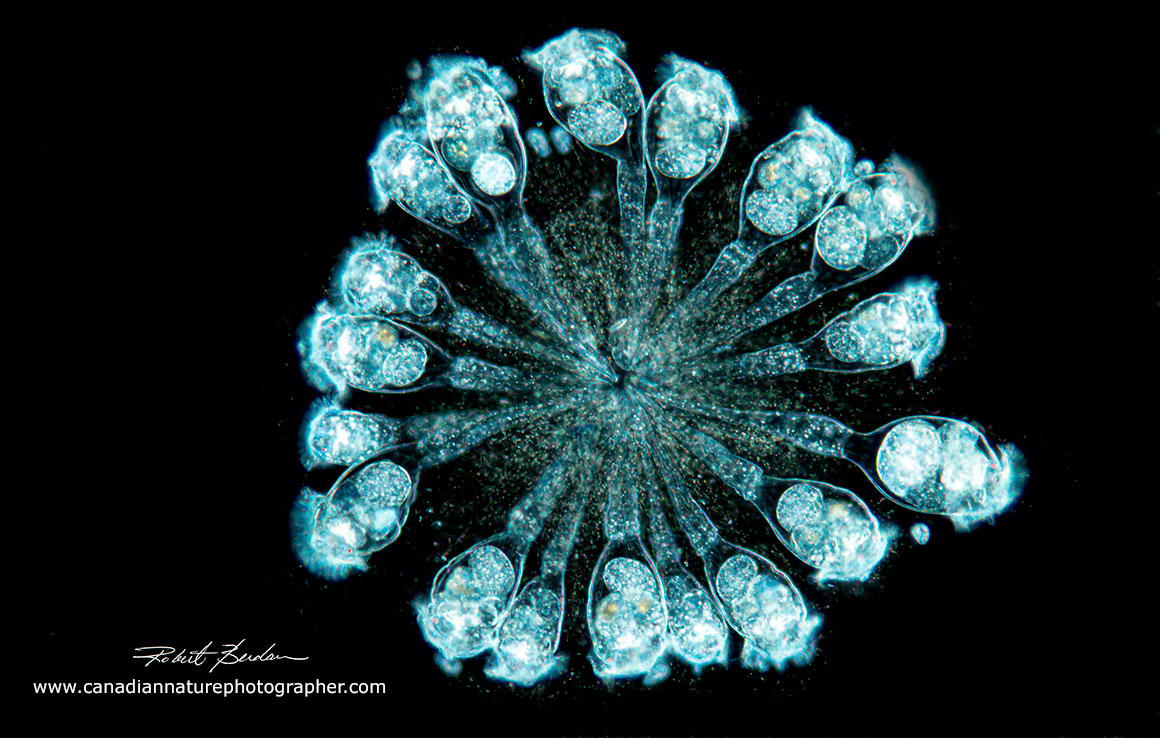 Conochilus hippocrepis darkfield microscopy 100X Robert Berdan ©